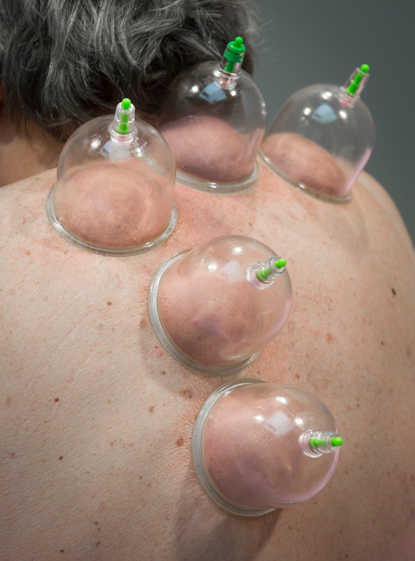 Velværesenteret Galleribilde