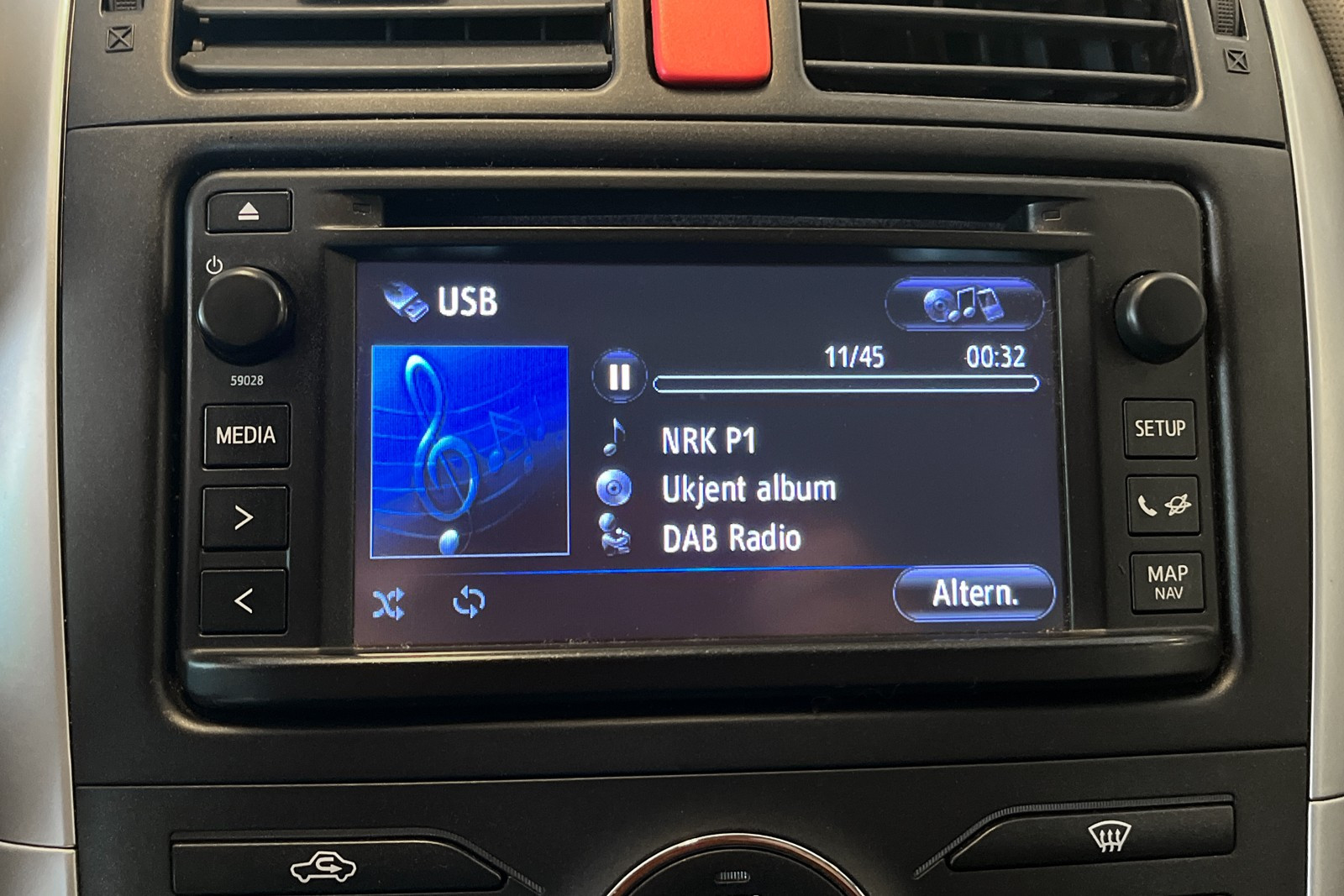 DAB radio