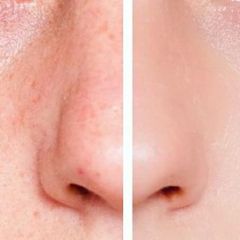 LED foryngende SPA maske for ansiktet; 7 programmer + GRATIS LED foryngende SPA maske for ansiktet; 7 programmer + GRATIS