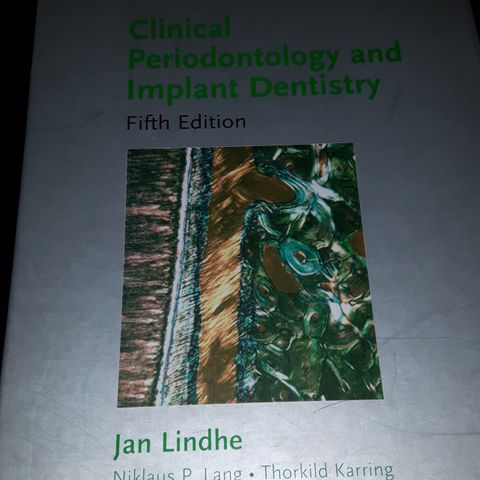 Jan Lindhe Clinical Periodontology and implant dentistry