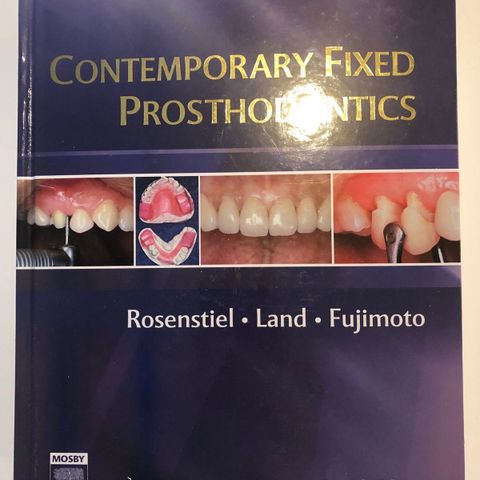 Contemporary fixed Prostodontics (fast protetikk)