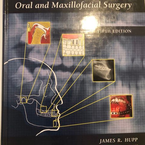 CONTEMPORARY Oral and Maxillofacial Surgery