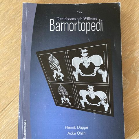 Barneortopedi