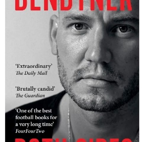 Bendtner Both Sides