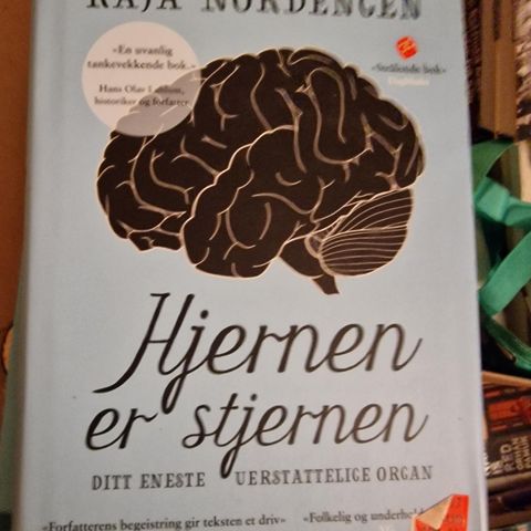 Hjernen er stjernen