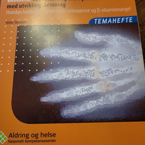 Temahefte. Beinhelse hos voksne og eldre personer med utviklingshemning