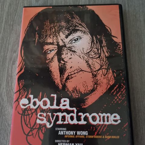 Ebola Syndrome