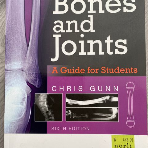 Radiografi, Bones and joints