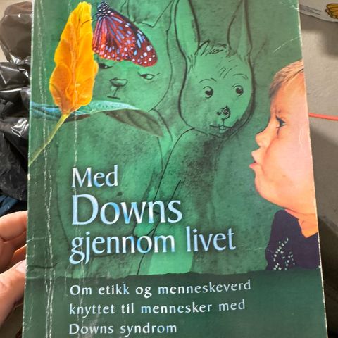 Med DOWNS gjennom livet