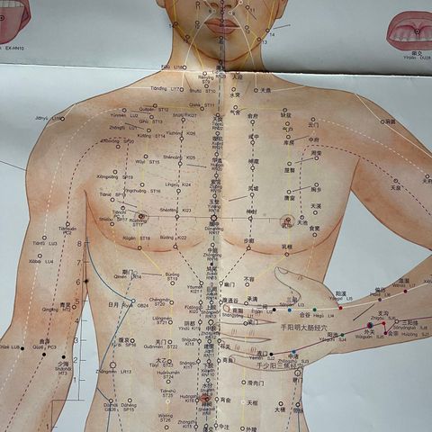 Acupuncture maps