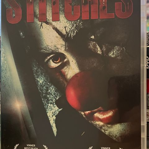 Stitches