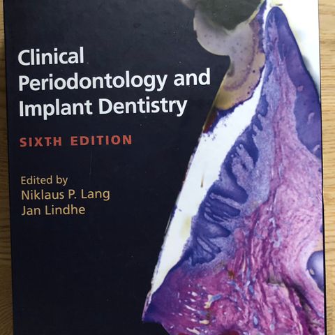 Lindhe's Clinical Periodontology and Implant Dentistry, 2 Volume Set 6. ed.