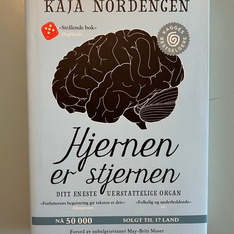 Hjernen er stjernen