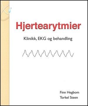 Hjertearytmier (Hegbom & Steen)