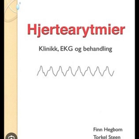 Ønskes kjøpt «Hjertearytmier» (Hegbom & Steen)