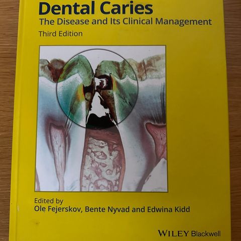 Dental Caries dental the disease and its clinical management. (Tannlegestudent)