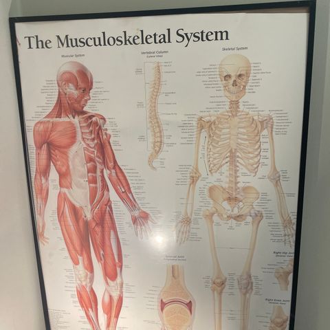 Anatomiplakat