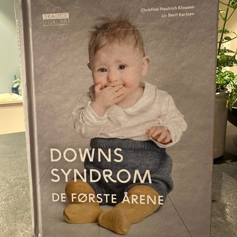 Downs syndrom - de første årene
