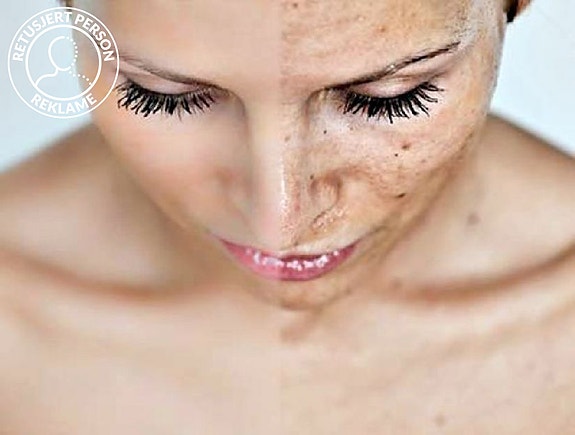 Eksperter på sunn hud og hudhelse