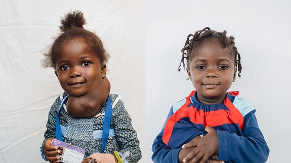 En svulst gjorde hverdagen tung og stjal både leken og tryggheten. Familien fryktet for fremtiden hennes. Da Umu fikk gratis kirurgi gjennom Mercy Ships, forsvant smerten – og et nytt liv kunne begynne. Nå kan hun le, leke og drømme igjen.