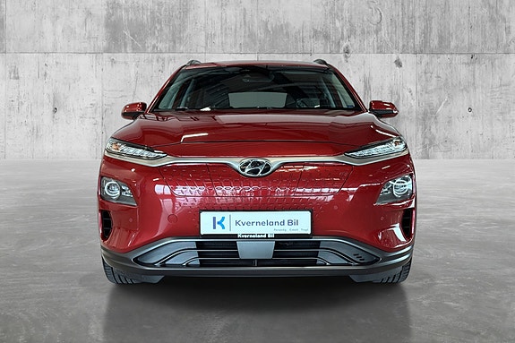 Hyundai Kona 2 of 5